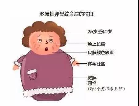 “我暂时不想要孩子，多囊可以不用治吗？”