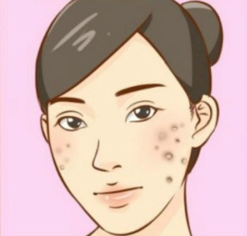 过敏性皮肤病应当如何治疗？