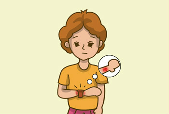 银屑病这种皮肤病并不传染，有效的预防让你远离银屑病