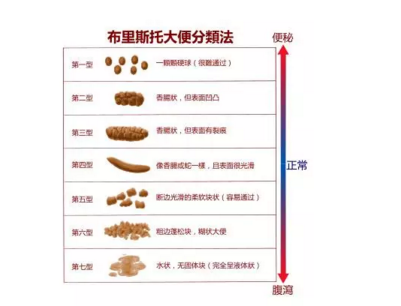 大便总黏马桶，冲也冲不干净，怎么回事？