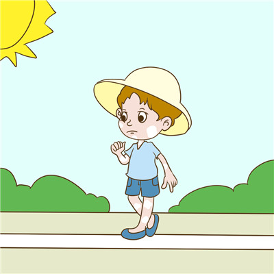 可怕的皮肤病白癜风会对眼睛造成伤害？