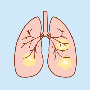 引发肺癌的8大因素，怎么吃才算健康?
