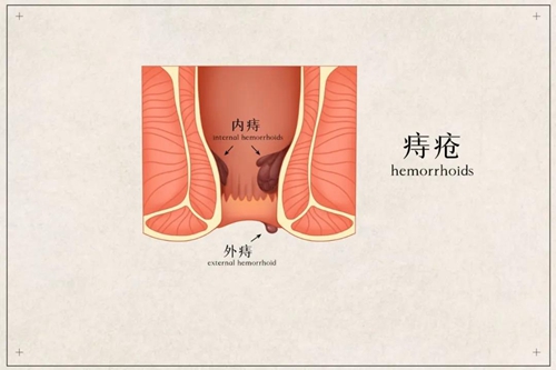 边上厕所边耍手机，听到，痔疮敲门 ing……