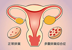 下面经常少量出血是怎么回事