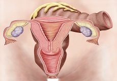 患有多囊卵巢会有什么症状呢？