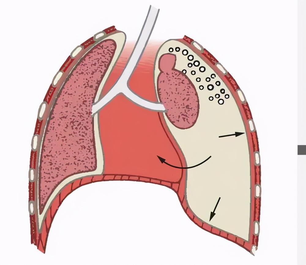 到底哪些因素会诱发哮喘的发作？