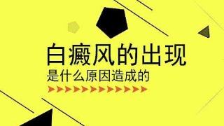 昆明治白斑专科医院：手部白癜风有哪些病因