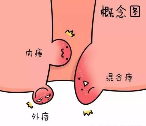 屁股有肉球脱出，是怎么回事呢？