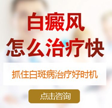 成都哪家医院的医生比较？好白癜风早期什么办法治疗的好呢?