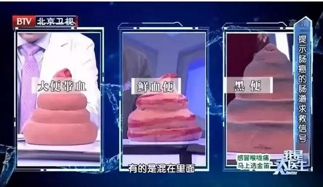 痔疮到底怎么治疗？要把握好4个要点！