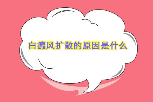 云南白斑专科医院哪家好？为什么男性的白癜风会发生扩散