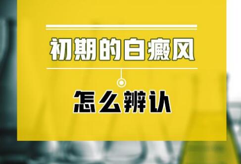 昆明哪家医院看白斑好？白癜风的早期症状有哪些