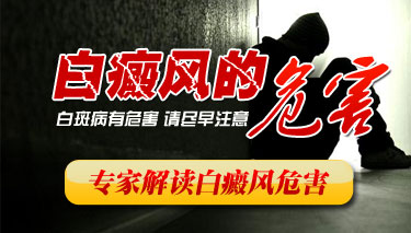 成都专治部位白癜风医院哪家好？腰部白癜风怎么治？