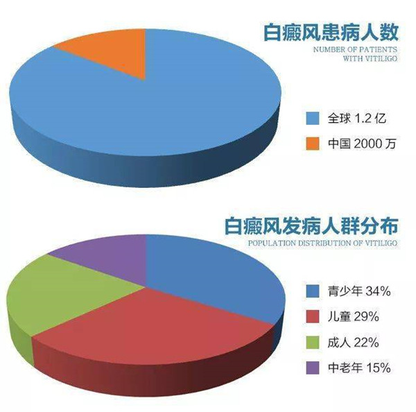 成都西部白癜风医院