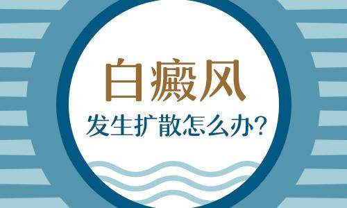 昆明看白斑病专科医院：白癜风扩散怎么办？