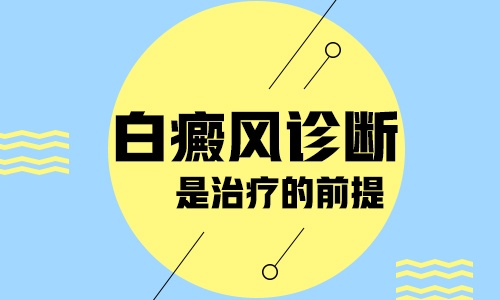 皮肤上长白斑就是白癜风吗