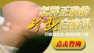 成都治白癜风去哪里？诊断白癜风的方法有哪些