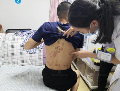 暑期“快速告白”行动，青少年强化治疗专项门诊