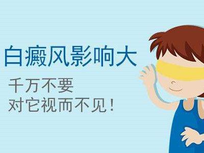 成都哪家医院治疗白斑病？眼睛周围出现白癜风有影响吗