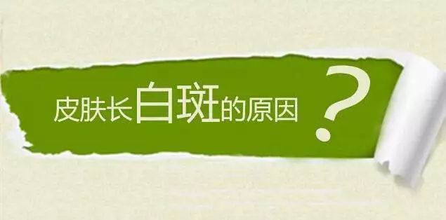 云南白斑病医院：你知道白癜风好发于哪些部位吗