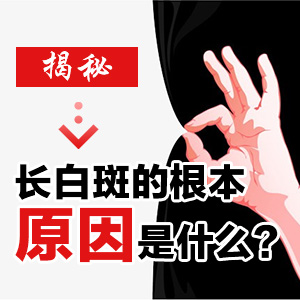 成都白癜风医院哪里好？了解女性白癜风的致病原因是什么