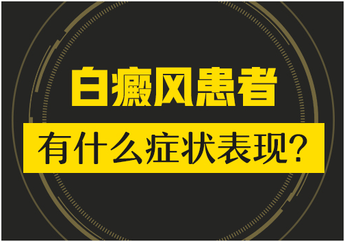 昆明看白斑病专科医院白癜风的症状主要特点是什么