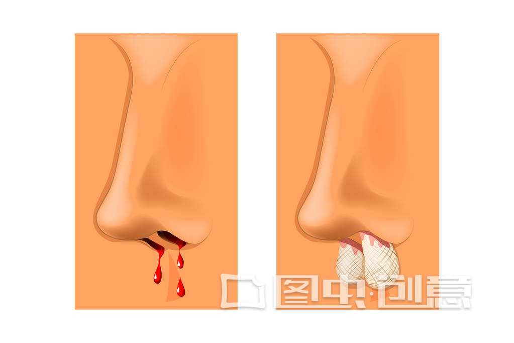 南昌看疾病造成的鼻出血
