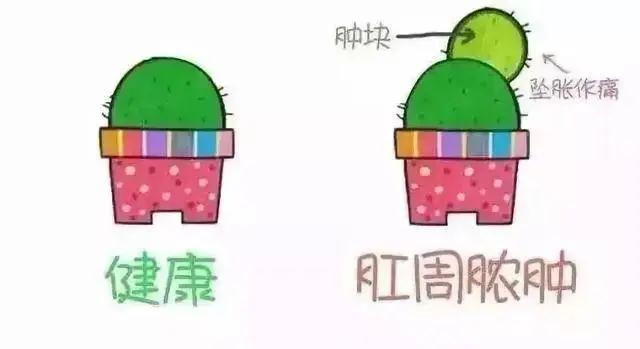 肛部总是有“异物感”别大意，可能与以下几种情况有关！