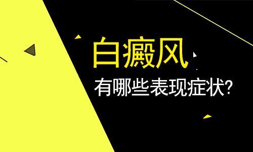 云南白斑医院在哪？白癜风有哪些症状?