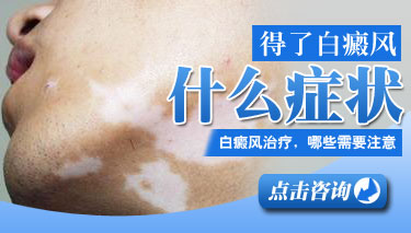 成都看白癜风去哪好？白癜风发生后有哪些症状表现呢