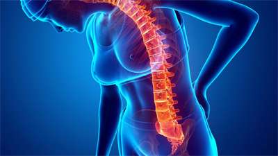 女性得了強直性脊柱炎要怎么確診呢
