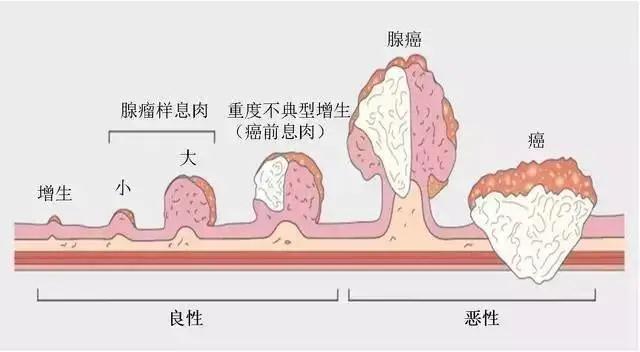 便秘危害知多少？