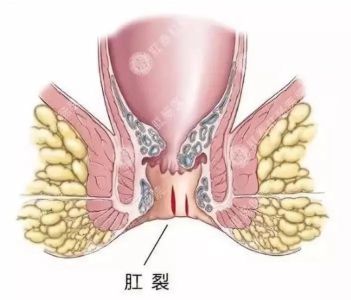 便秘危害知多少？