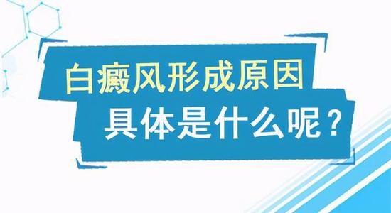 成都有治疗白癜风的吗？白癜风的病因有哪些