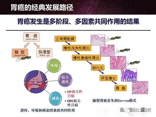 浅表性胃炎（非萎缩性胃炎），需要治疗吗？