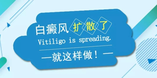 白癜风不扩散可以暂时不治疗吗?