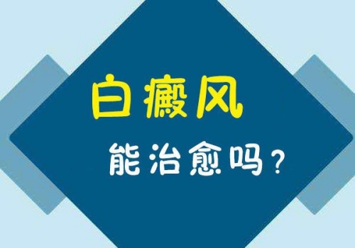 白癜风真的没有办法治好了吗？