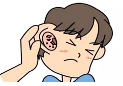 哈尔滨治疗外耳炎有什么方法？