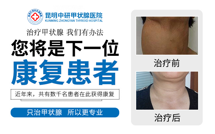 昆明好的治甲状腺结节医院_昆明中研甲状腺专科医院