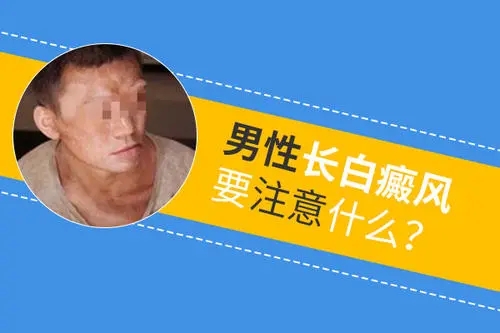 北京治疗白癜风专科医院？男性白癜风如何护理？