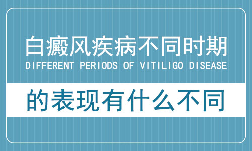 北京白癜风医院治疗方案？如何预防白癜风的扩散？