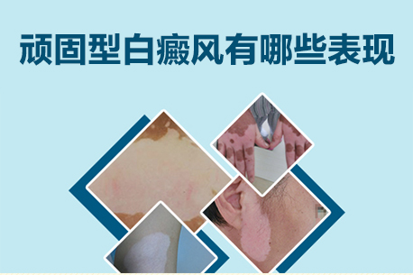 郑州西京白癜风医院治--果好不好，为什么要这么重视白癜风的治疗，白癜风会引起什么并发症