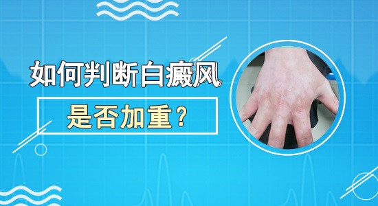 北京哪家医院治疗白癜风比较好？白癜风有哪些好的治疗方法？