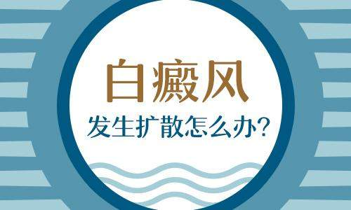 北京去哪里看白癜风？白癜风扩散的原因是什么？