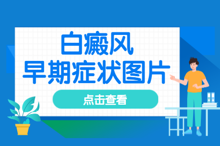 郑州西京白癜风医院治疗白斑好不好，郑州西京白癜风医院治疗儿童白癜风好不好，郑州西京白癜风医院是不是正规医院