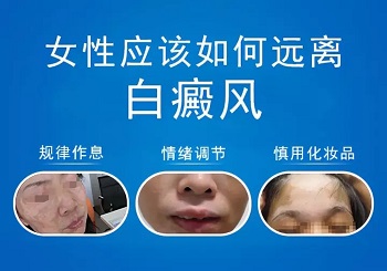 北京哪家医院治疗白癜风比较好？患白癜风要注意什么？