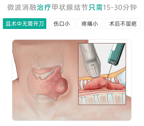 【肿瘤防治宣传周】甲状腺结节和甲状腺癌有什么关系？该如何应对？ 