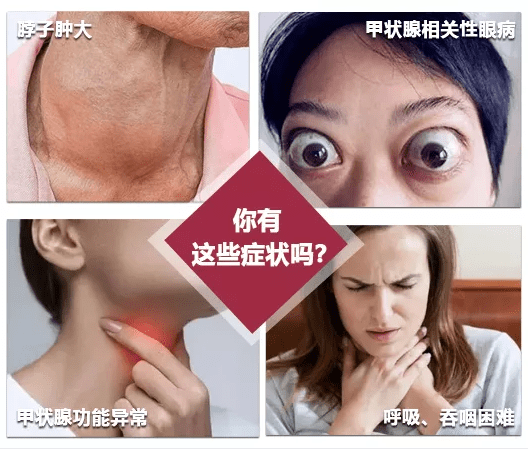 【致敬劳动者·公益惠民生】昆明中研甲状腺医院联合正规甲状腺医生会诊活动开始啦!