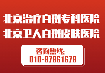 北京有没有好的白癜风医生？白癜风朋友怎样才能尽快--白癜风？