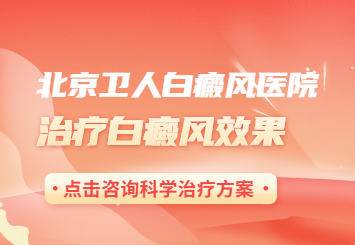 北京哪里治疗白癜风好？不想白癜风长满到全身怎么办